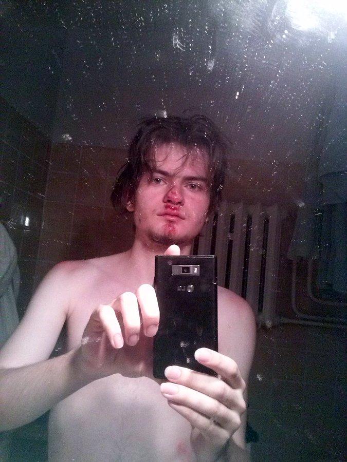 Moja twarz po kilkumetrowym szlifie po asfalcie... :(