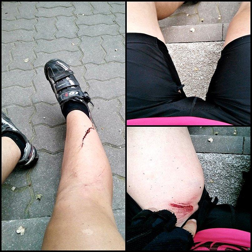 Prawa noga rozcięta (dobę później krew się jeszcze leje), prawa łydka skurcz, rozdarte spodenki, oby tylko stłuczenie mięśnia plus kolejna rana na lewym udzie