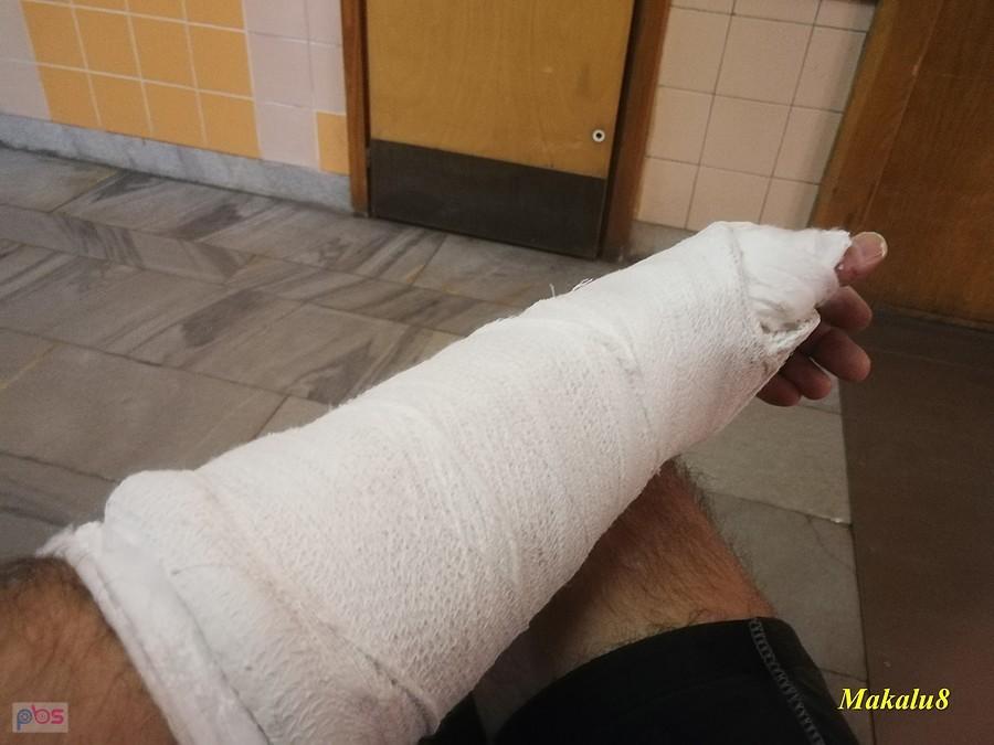 Niespodziewany koniec wycieczki